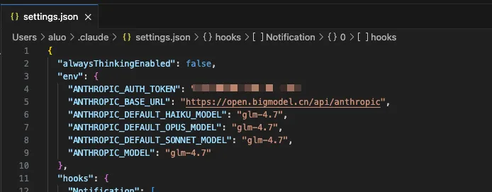 settings.json 配置效果
